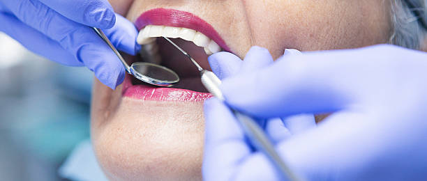 Best Emergency Root Canal Treatment in Glencoe, AL